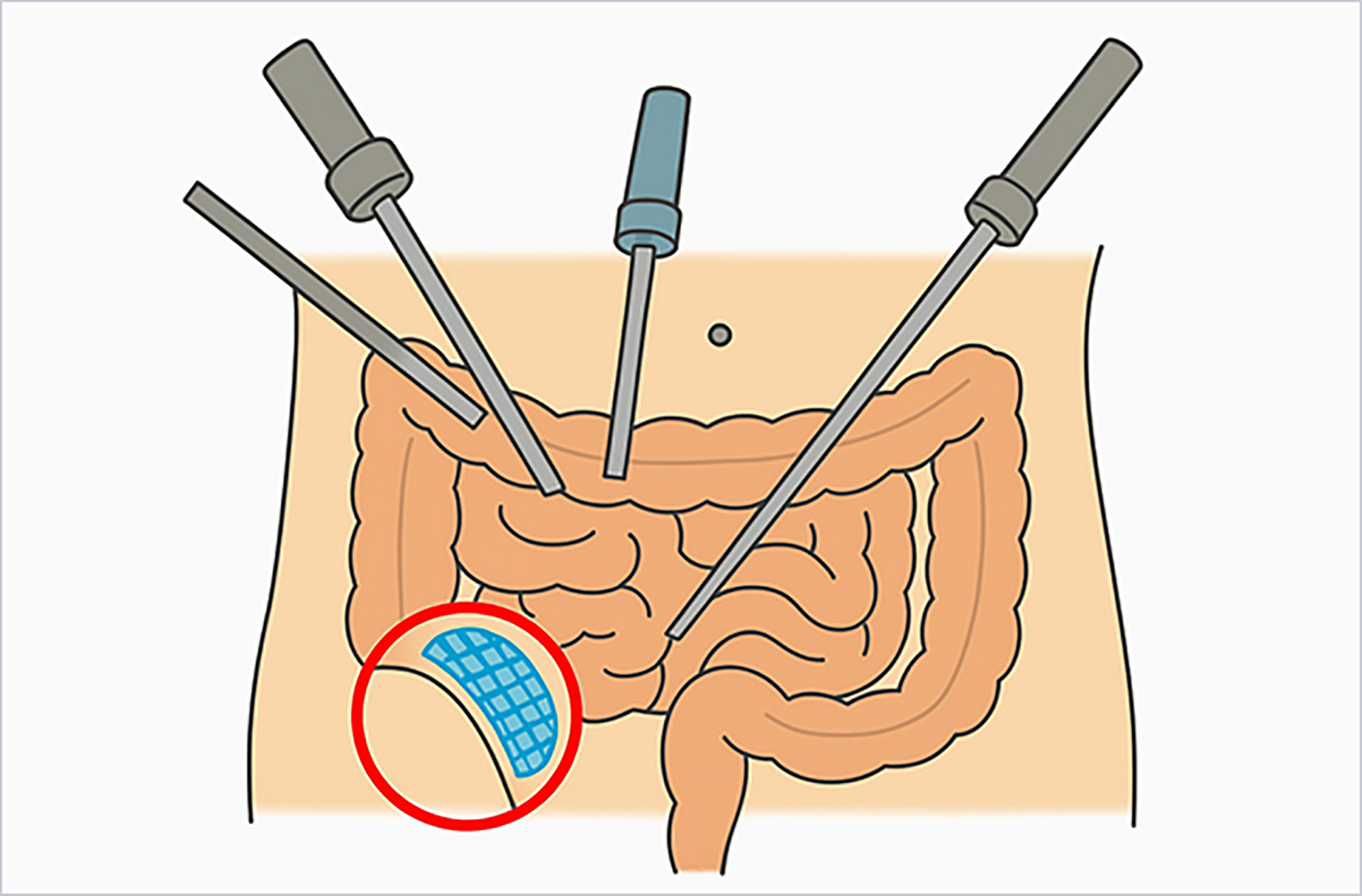현재 널리 시행되는 방식