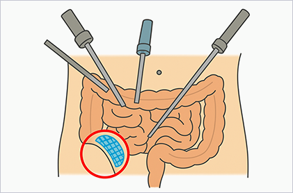 현재 널리 시행되는 방식