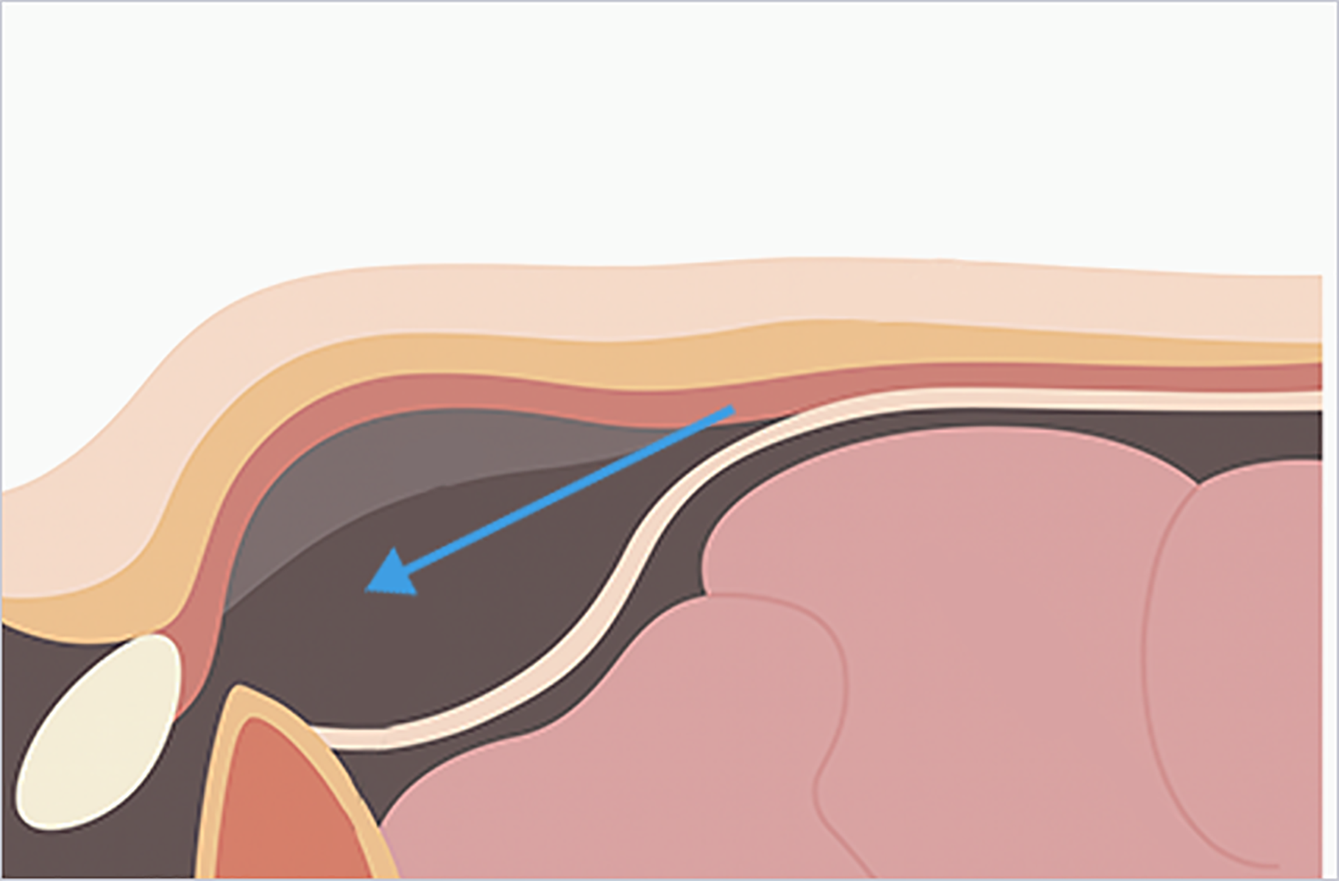 영등포병원의 수술 방식