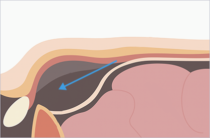 영등포병원의 수술 방식