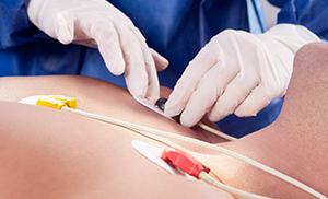 심전도 검사(EKG)